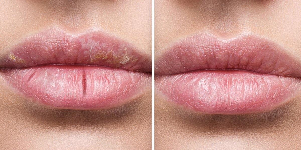 labios resecpos mas belleza y salud