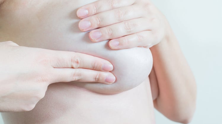 Aprende los pasos del autoexamen de mamas 